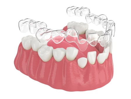 Beautiful New Smile Hardy Pediatric Dentistry & Orthodontics Lakewood