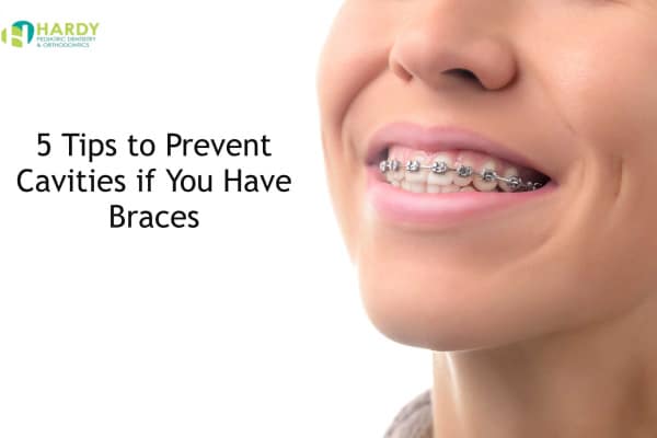 Dental braces - Wikipedia