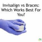 Invisalign vs Braces : Which One is Best For You?