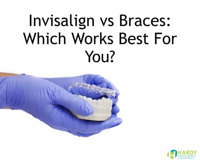 Braces vs. Invisalign: A Visual Guide to Your Orthodontic