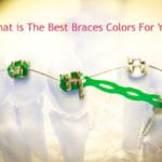Pick the best colors for your braces bands