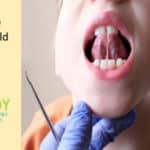 How to Help Your Child Recover from Tongue-Tie Surgery
